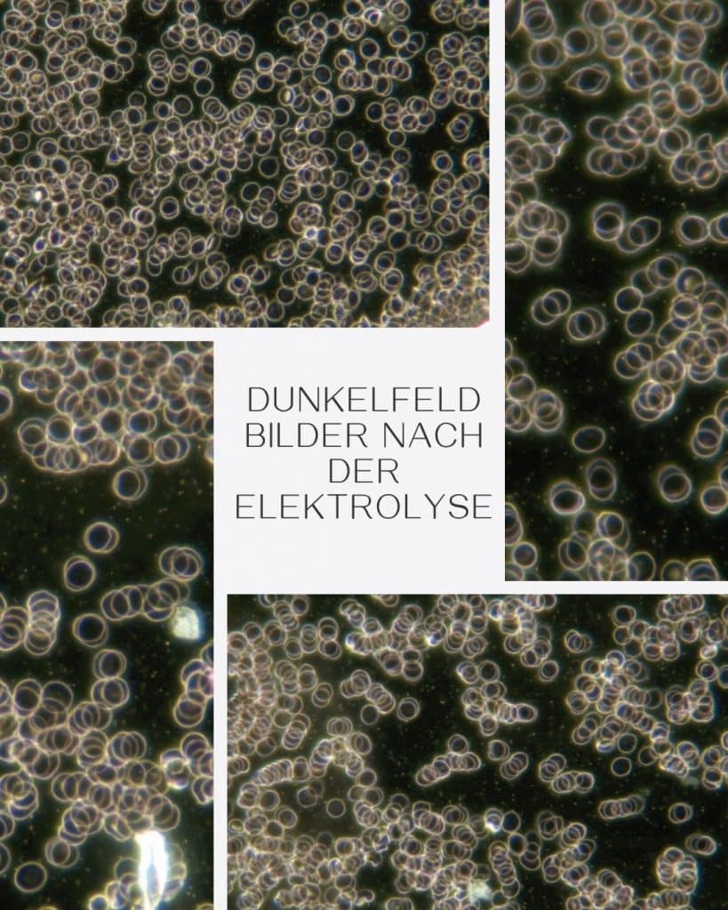 Dunkelfeldbild nach der Elektrolyse